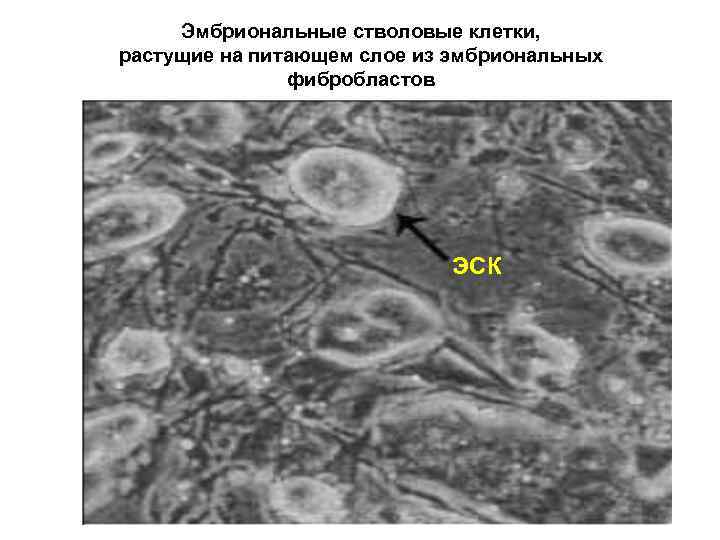 Эмбриональные стволовые клетки, растущие на питающем слое из эмбриональных фибробластов ЭСК 