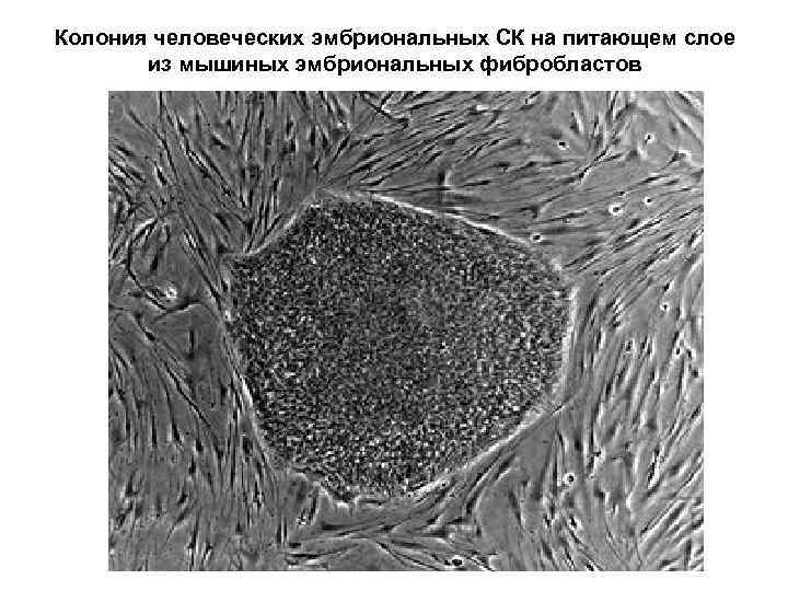 Колония человеческих эмбриональных СК на питающем слое из мышиных эмбриональных фибробластов 