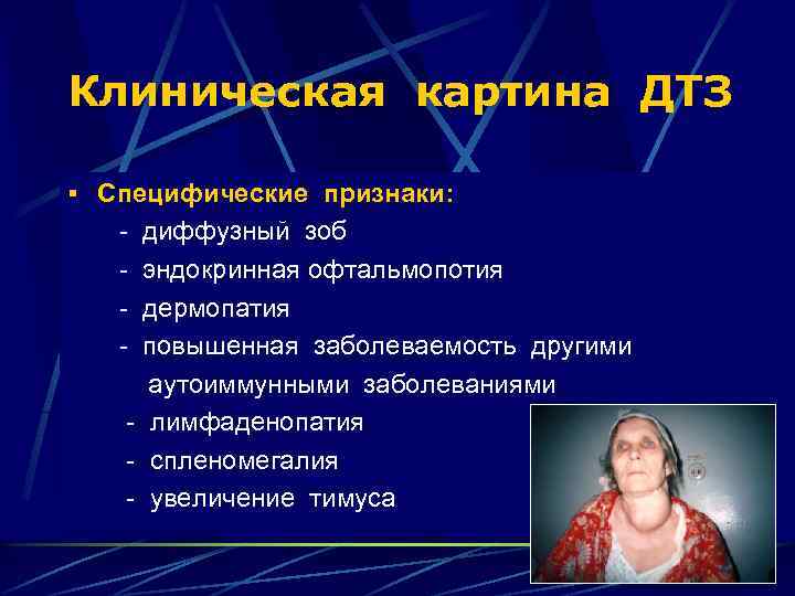 Клиническая картина ДТЗ § Специфические признаки: - диффузный зоб - эндокринная офтальмопотия - дермопатия