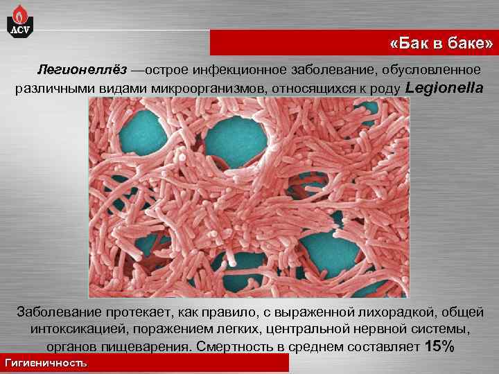  «Бак в баке» Легионеллёз —острое инфекционное заболевание, обусловленное различными видами микроорганизмов, относящихся к