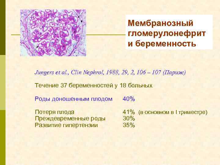 Мембранозный гломерулонефрит и беременность Jungers et al. , Clin Nephrol, 1988, 29, 2, 106