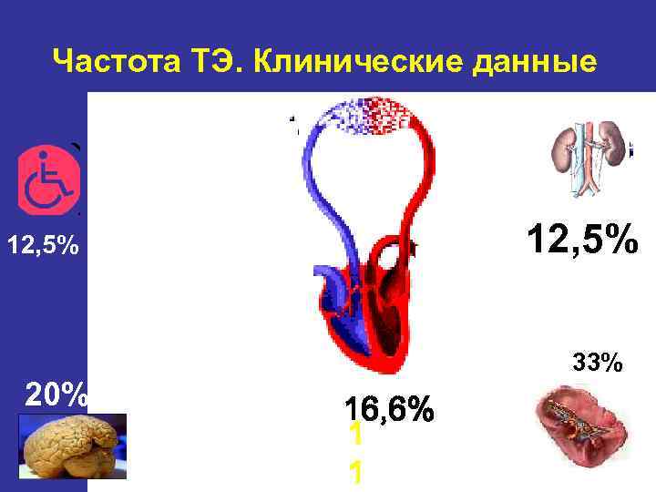 Частота ТЭ. Клинические данные 12, 5% 20% 33% 11% 16, 6% 1 1 
