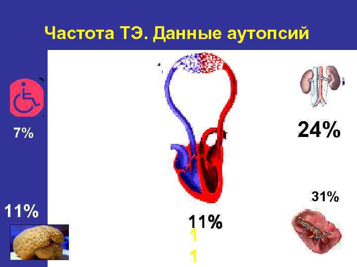 Клиническая картина инфекционного эндокардита