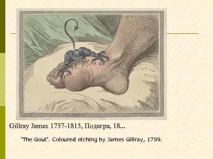 Gillray James 1757 -1815, Подагра, 18. . . 'The Gout'. Coloured etching by James