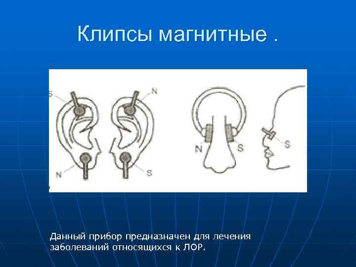 Клипсы магнитные. Данный прибор предназначен для лечения заболеваний относящихся к ЛОР. 