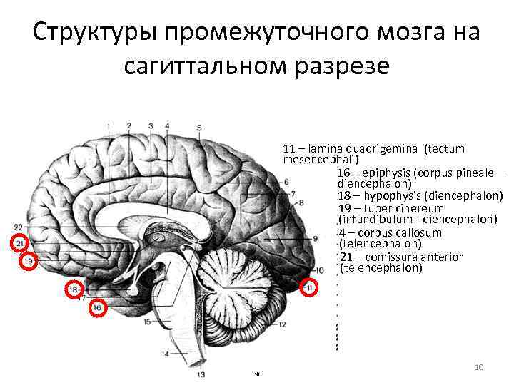 Общий план строения мозга в сагиттальном разрезе