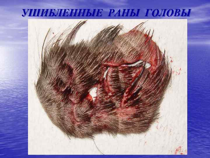 УШИБЛЕННЫЕ РАНЫ ГОЛОВЫ 