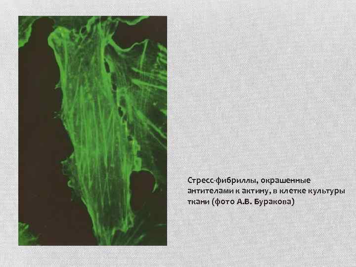 Стресс-фибриллы, окрашенные антителами к актину, в клетке культуры ткани (фото А. В. Буракова) 