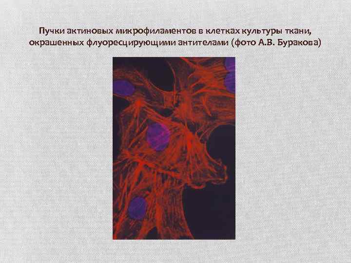 Пучки актиновых микрофиламентов в клетках культуры ткани, окрашенных флуоресцирующими антителами (фото А. В. Буракова)