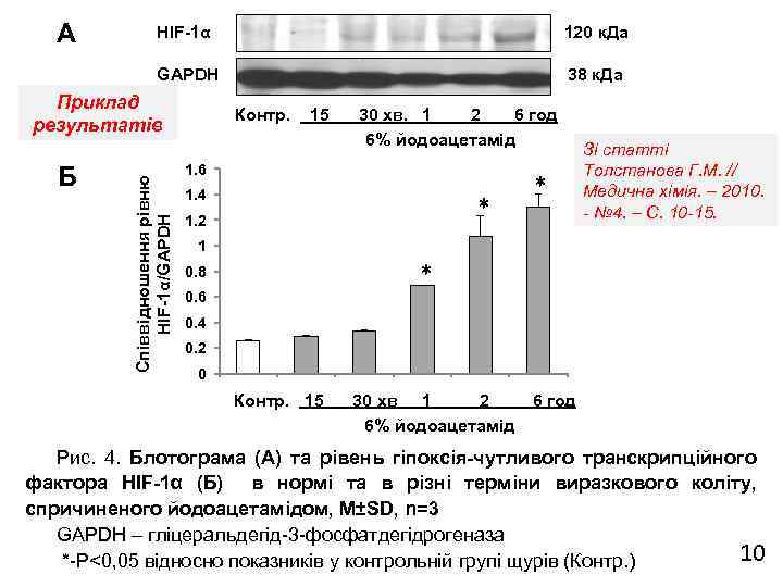 А HIF-1α 120 к. Да GAPDH 38 к. Да Б Співвідношення рівню HIF-1α/GAPDH Приклад