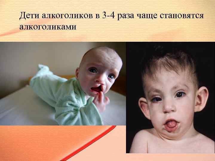 Дети алкоголиков в 3 -4 раза чаще становятся алкоголиками 