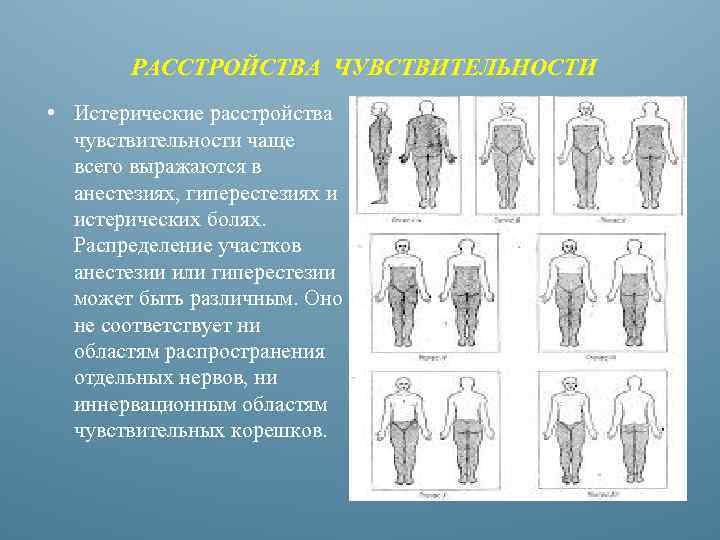 РАССТРОЙСТВА ЧУВСТВИТЕЛЬНОСТИ • Истерические расстройства чувствительности чаще всего выражаются в анестезиях, гиперестезиях и истерических