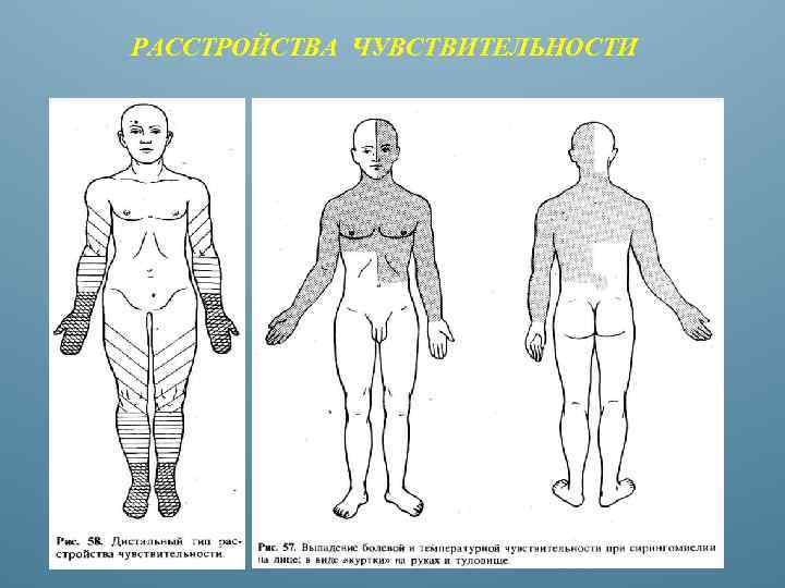 РАССТРОЙСТВА ЧУВСТВИТЕЛЬНОСТИ 