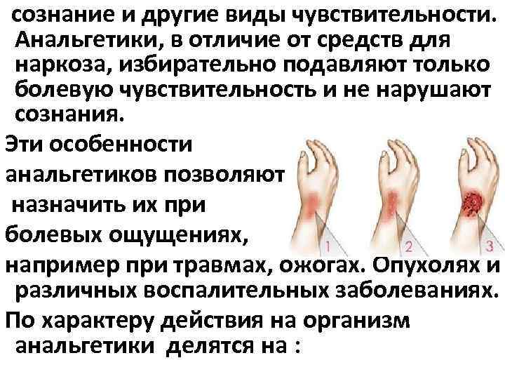 сознание и другие виды чувствительности. Анальгетики, в отличие от средств для наркоза, избирательно подавляют