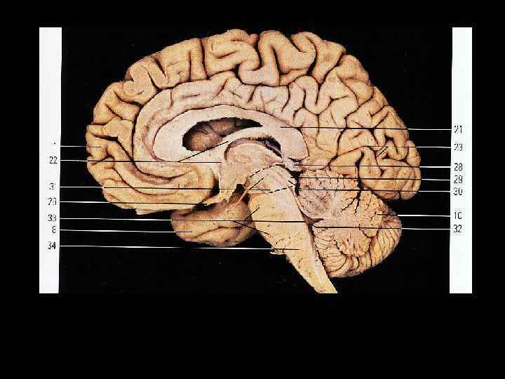 Головной мозг, сагиттальный разрез 1 – лобная доля; 8 – височная доля; 10 –