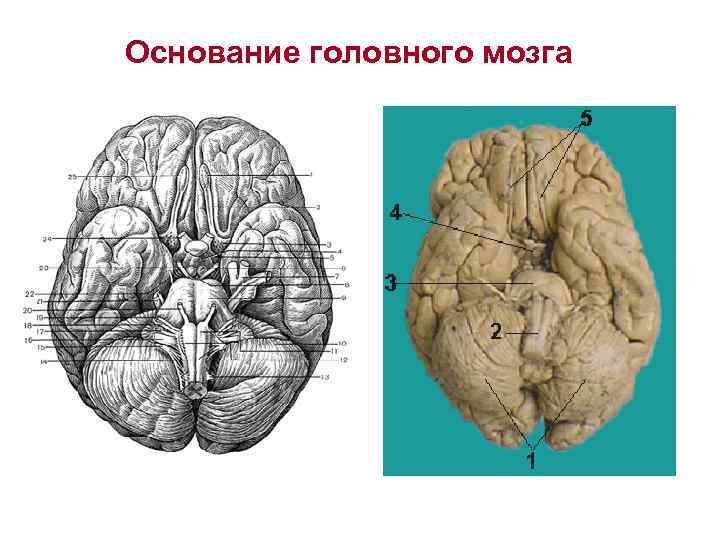 Складчатая поверхность головного мозга. Анатомические образования основания головного мозга. Нижняя поверхность основание головного мозга. Основание головного мозга препарат. Базальная поверхность мозга.