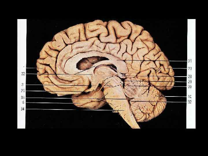 Головной мозг, сагиттальный разрез 1 – лобная доля; 8 – височная доля; 10 –