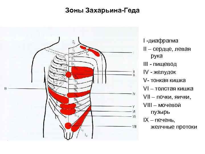 Зоны Захарьина-Геда I -диафрагма II – сердце, левая рука III - пищевод IV -