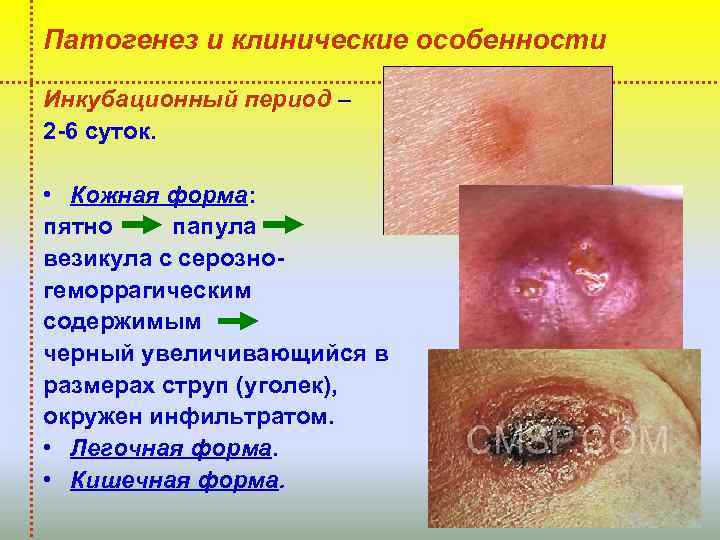 Патогенез и клинические особенности Инкубационный период – 2 -6 суток. • Кожная форма: пятно