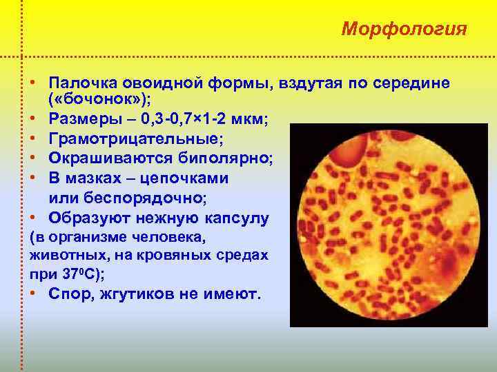 Морфология • Палочка овоидной формы, вздутая по середине ( «бочонок» ); • Размеры –