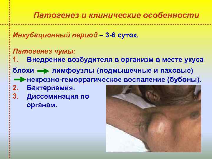 Патогенез и клинические особенности Инкубационный период – 3 -6 суток. Патогенез чумы: 1. Внедрение