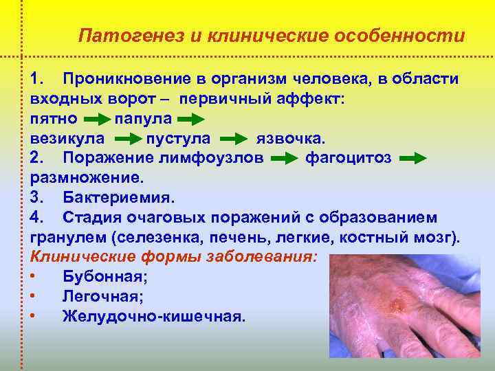Патогенез и клинические особенности 1. Проникновение в организм человека, в области входных ворот –