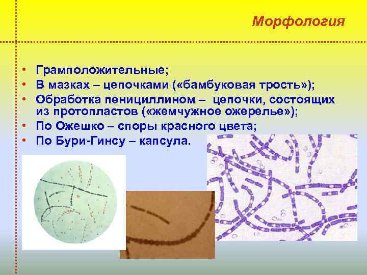 Морфология • Грамположительные; • В мазках – цепочками ( «бамбуковая трость» ); • Обработка