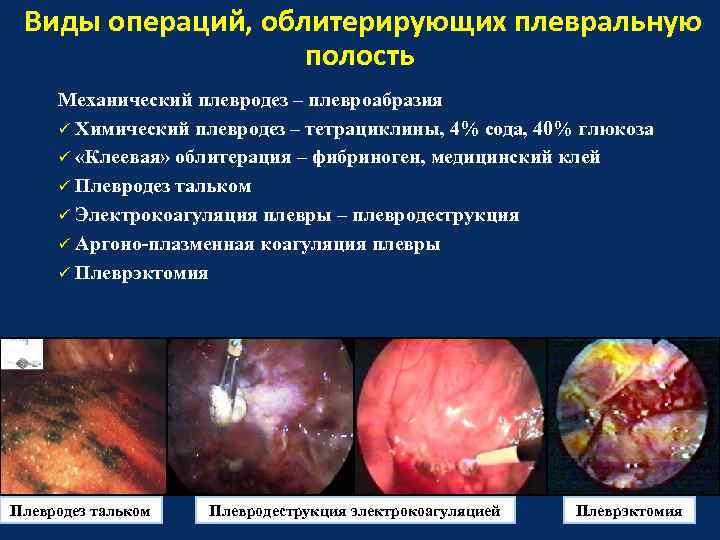 Виды операций, облитерирующих плевральную полость Механический плевродез – плевроабразия ü Химический плевродез – тетрациклины,