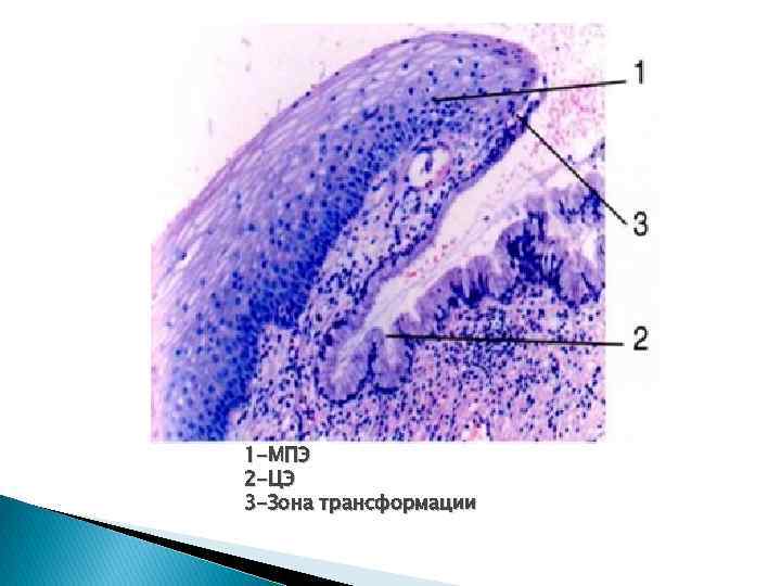 1 -МПЭ 2 -ЦЭ 3 -Зона трансформации 