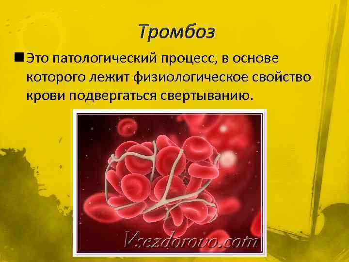 Тромбоз n Это патологический процесс, в основе которого лежит физиологическое свойство крови подвергаться свертыванию.