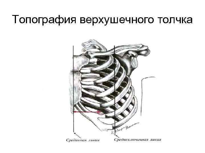 Топография верхушечного толчка 