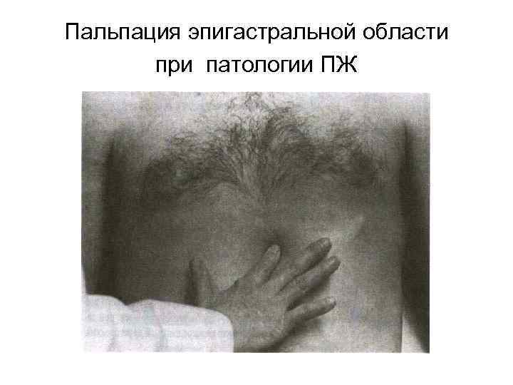 Пальпация эпигастральной области при патологии ПЖ 