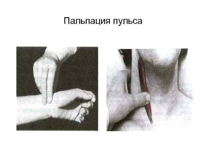 Пальпация пульса 