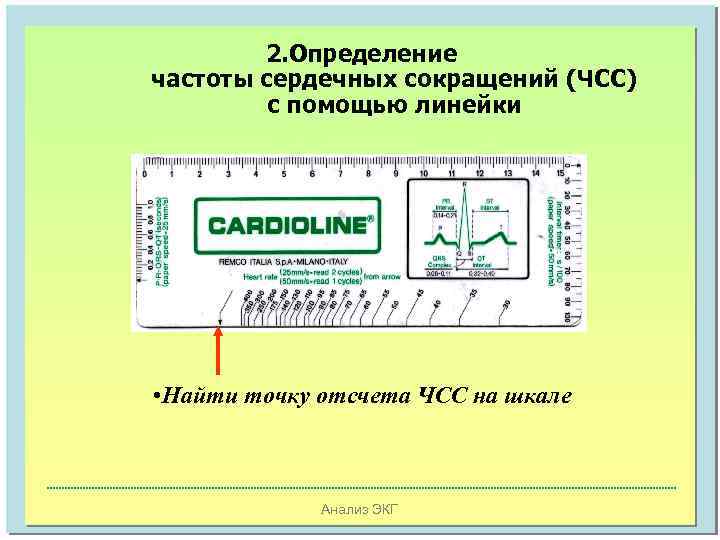 2. Определение частоты сердечных сокращений (ЧСС) с помощью линейки • Найти точку отсчета ЧСС