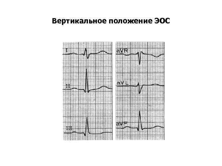 Вертикальное положение ЭОС 