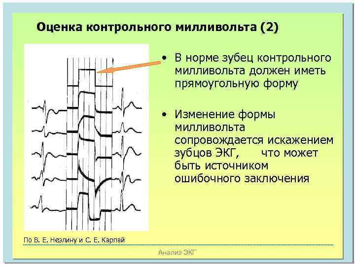 Оценка контрольного милливольта (2) • В норме зубец контрольного милливольта должен иметь прямоугольную форму