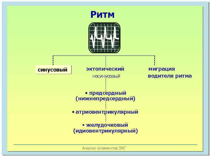 Ритм синусовый эктопический несинусовый • предсердный (нижнепредсердный) • атриовентрикулярный • желудочковый (идиовентрикулярный) Анализ элементов