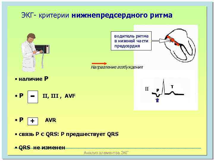 ЭКГ- критерии нижнепредсердного ритма водитель ритма в нижней части предсердия Направление возбуждения • наличие