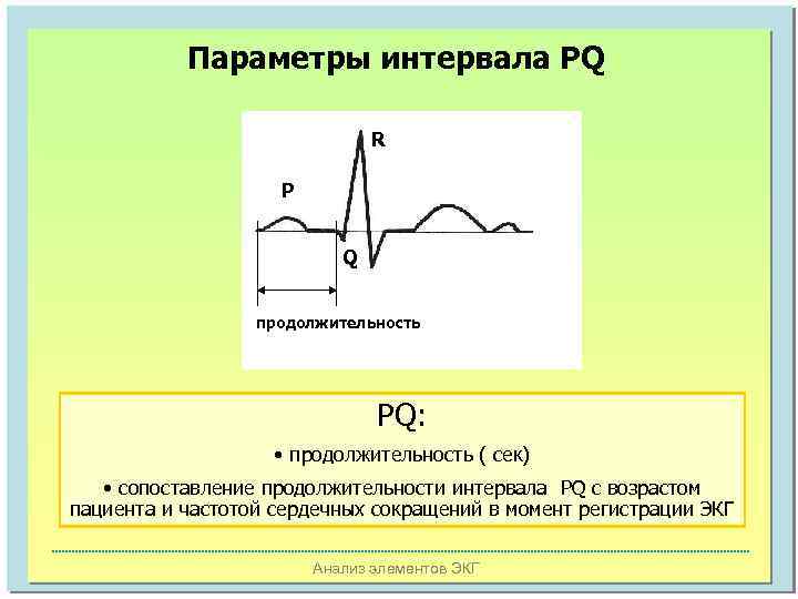 Параметры интервала PQ R P Q продолжительность PQ: • продолжительность ( сек) • сопоставление