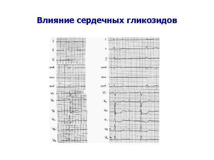 Влияние сердечных гликозидов 