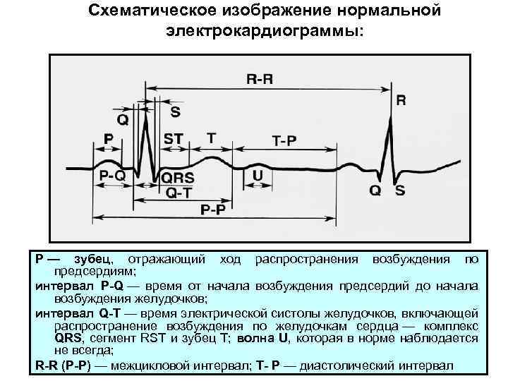 Схематическое изображение нормальной электрокардиограммы: Р — зубец, отражающий ход распространения возбуждения по предсердиям; интервал