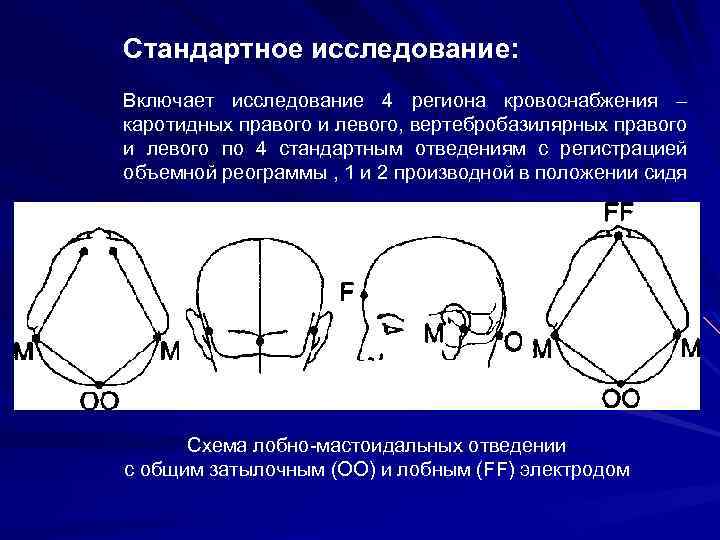 Стандартное исследование: Включает исследование 4 региона кровоснабжения – каротидных правого и левого, вертебробазилярных правого