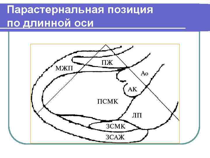 Парастернальная позиция по длинной оси 