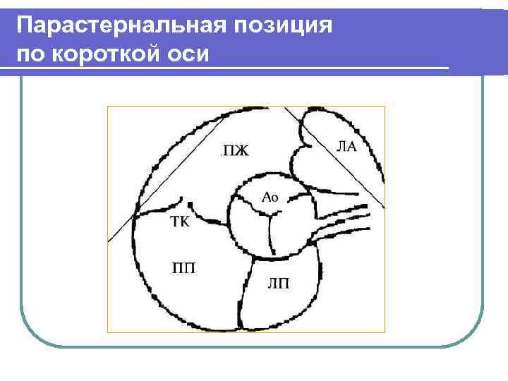 Парастернальная позиция по короткой оси 