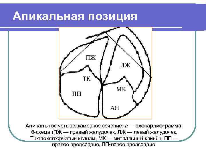 Апикальная позиция Апикальное четырехкамерпое сечение: а — эхокарлиограмма; б-схема (ПЖ — правый желудочек, ЛЖ