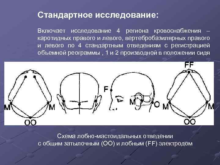 Стандартное исследование: Включает исследование 4 региона кровоснабжения – каротидных правого и левого, вертебробазилярных правого