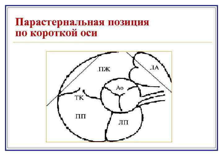 Парастернальная позиция по короткой оси 