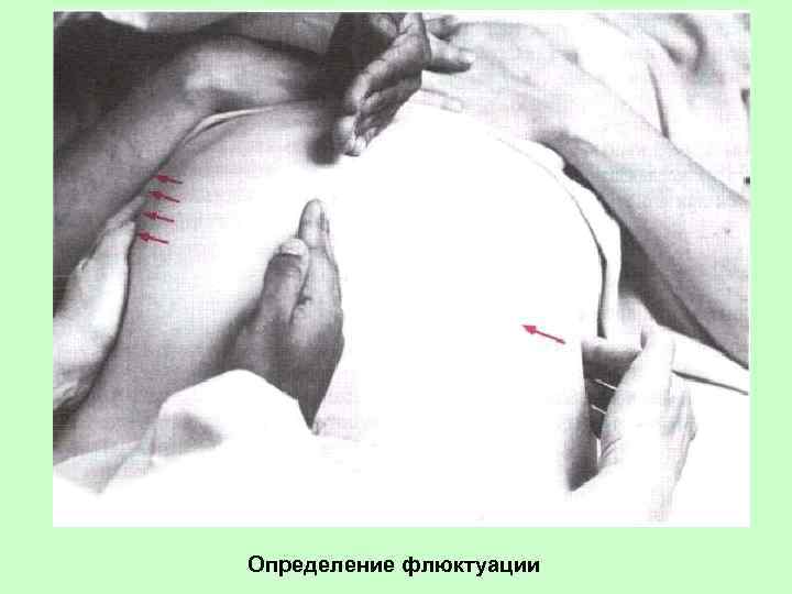 Определение флюктуации 