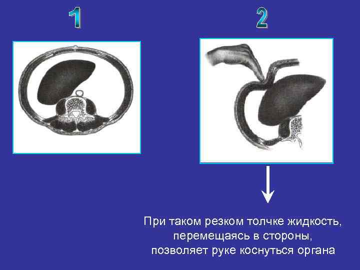 При таком резком толчке жидкость, перемещаясь в стороны, позволяет руке коснуться органа 