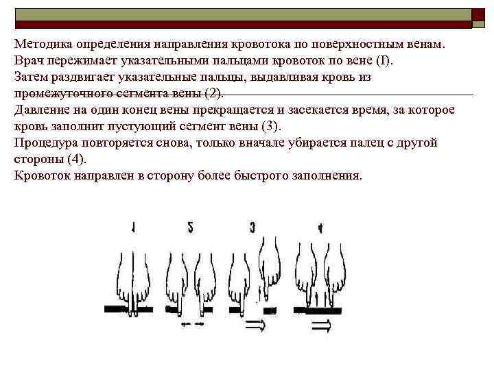 Методика определения направления кровотока по поверхностным венам. Врач пережимает указательными пальцами кровоток по вене